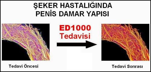ED100